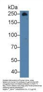 Fibronectin (FN) Antibody