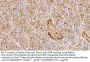 Fibronectin (FN) Antibody