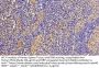 Fibronectin (FN) Antibody