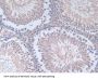 Fibronectin Antibody