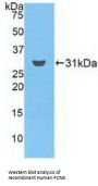 Ficolin 3 (FCN3) Antibody