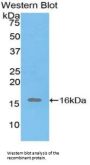 Inhibin Alpha (INHA) Antibody