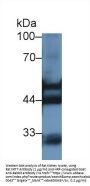 Keratin 7 (KRT7) Antibody