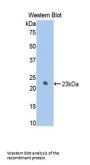 Keratin 7 (KRT7) Antibody