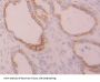 Keratin 7 (KRT7) Antibody