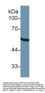 Keratin 8 (KRT8) Antibody
