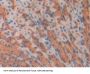 Myostatin (MSTN) Antibody