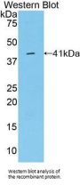 Osteocalcin (BGLAP) Antibody