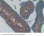 Osteocalcin (BGLAP) Antibody