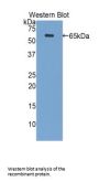 Periplakin (PPL) Antibody