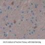 Periplakin (PPL) Antibody