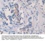 Septin 5 (SEPTIN5) Antibody