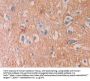 Septin 5 (SEPTIN5) Antibody