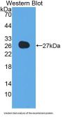 Adiponectin (ADIPOQ) Antibody