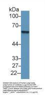 Antithrombin (AT) Antibody