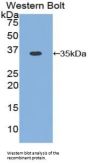 Cyclin D1 (CCND1) Antibody