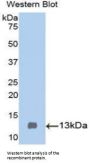 Cystatin C (CST3) Antibody