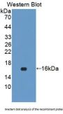 Cystatin A (CSTA) Antibody