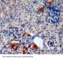 Cystatin A (CSTA) Antibody