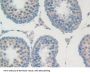 Fibulin 1 (FBLN1) Antibody