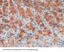 Fibulin 1 (FBLN1) Antibody