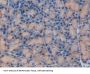 Fibulin 1 (FBLN1) Antibody
