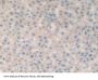 Fibulin 1 (FBLN1) Antibody