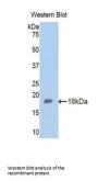 Fibulin 5 Antibody