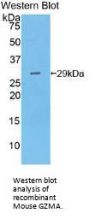 Granzyme A (GZMA) Antibody
