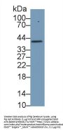 Haptoglobin Beta Chain (HP) Antibody