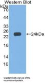 Haptoglobin Beta Chain (HP) Antibody