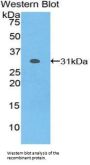 Nicastrin (NCSTN) Antibody