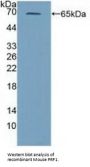 Perforin 1 (PRF1) Antibody