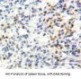 Perforin 1 (PRF1) Antibody