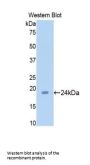 Sirtuin 5 (SIRT5) Antibody