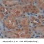 Sirtuin 5 (SIRT5) Antibody