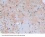 Syndecan 1 (SDC1) Antibody