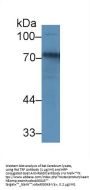 Transferrin Antibody