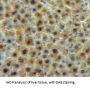 Transferrin Antibody