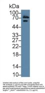 Transferrin (TF) Antibody
