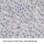 Transferrin (TF) Antibody
