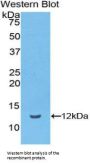 Vitronectin (VTN) Antibody