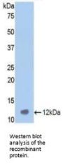 Vitronectin (VTN) Antibody