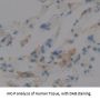 Vitronectin (VTN) Antibody
