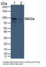 Aconitase 1 (ACO1) Antibody