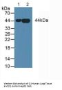 Annexin A3 (ANXA3) Antibody
