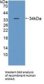 Annexin A5 (ANXA5) Antibody