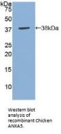 Annexin A5 (ANXA5) Antibody