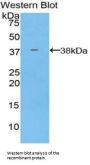 Annexin A5 (ANXA5) Antibody