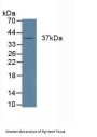 Cathepsin K Antibody